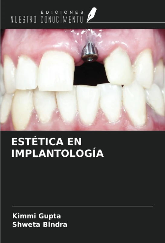 ESTÉTICA EN IMPLANTOLOGÍA