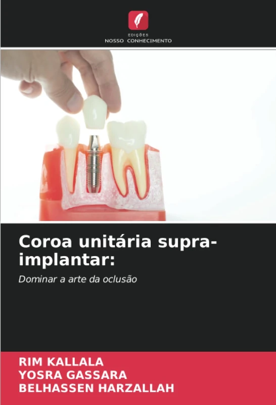 Coroa unitária supra-implantar:: Dominar a arte da oclusão