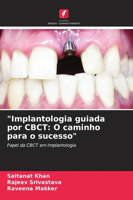 "Implantologia guiada por CBCT: O caminho para o sucesso": Papel da CBCT em Implantologia
