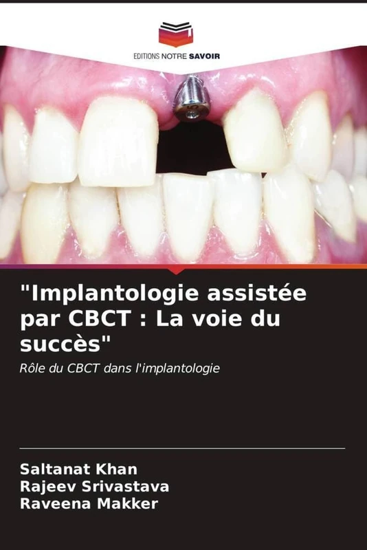 "Implantologie assistée par CBCT : La voie du succès": Rôle du CBCT dans l'implantologie