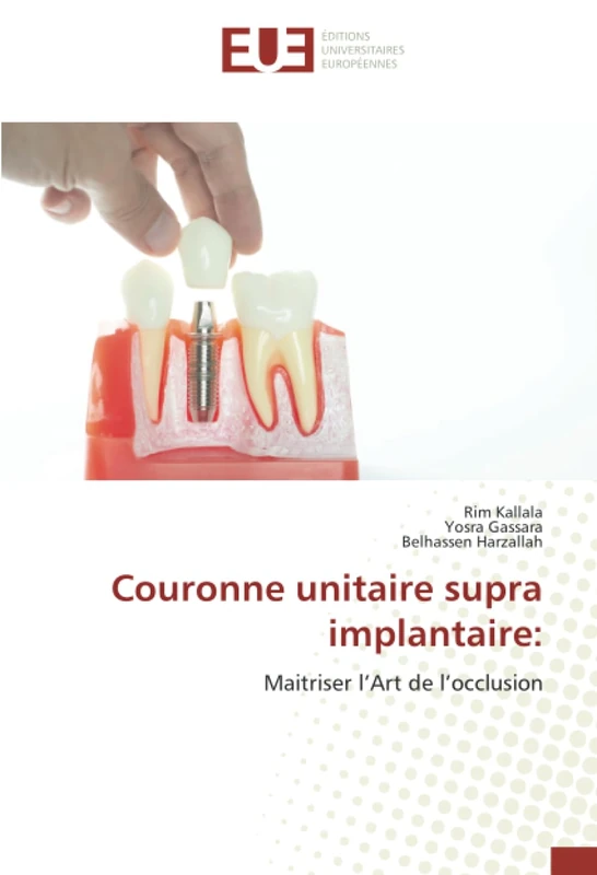 Couronne unitaire supra implantaire:: Maitriser l’Art de l’occlusion
