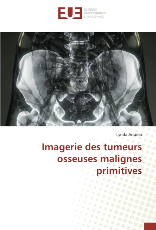 Imagerie des tumeurs osseuses malignes primitives - Image 1