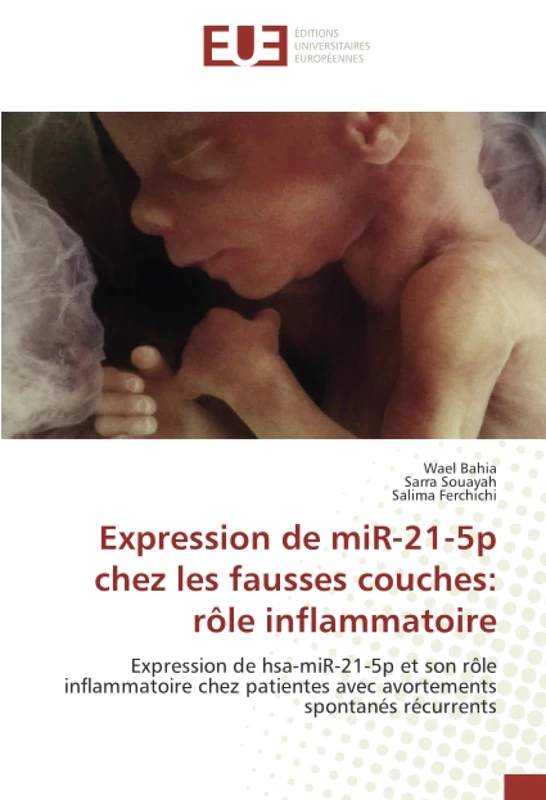 Expression de miR-21-5p chez les fausses couches: rôle inflammatoire: Expression de hsa-miR-21-5p et son rôle inflammatoire chez patientes avec avortements spontanés récurrents