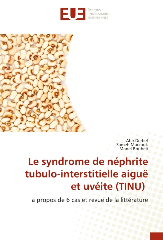 Le syndrome de néphrite tubulo-interstitielle aiguë et uvéite (TINU): a propos de 6 cas et revue de la littérature - Image 1