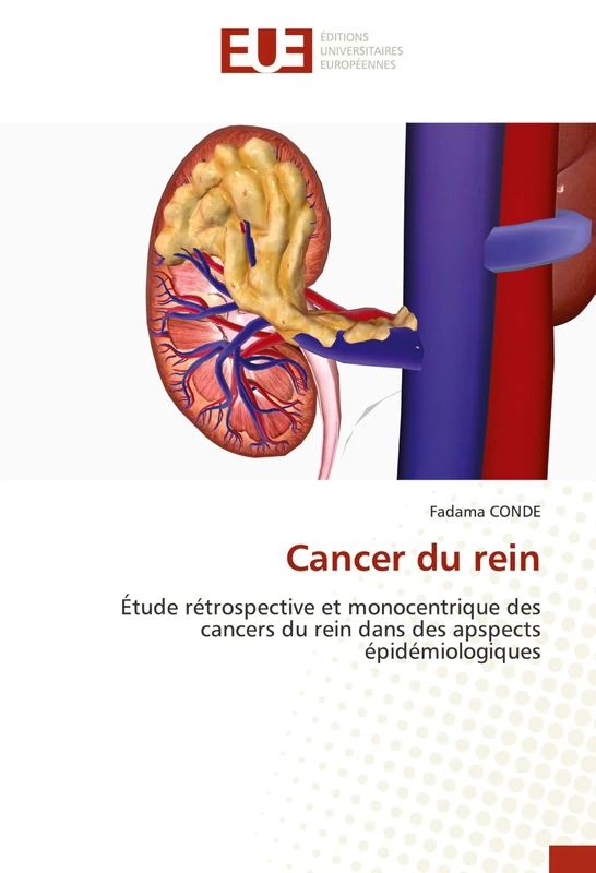 Cancer du rein: Étude rétrospective et monocentrique des cancers du rein dans des apspects épidémiologiques