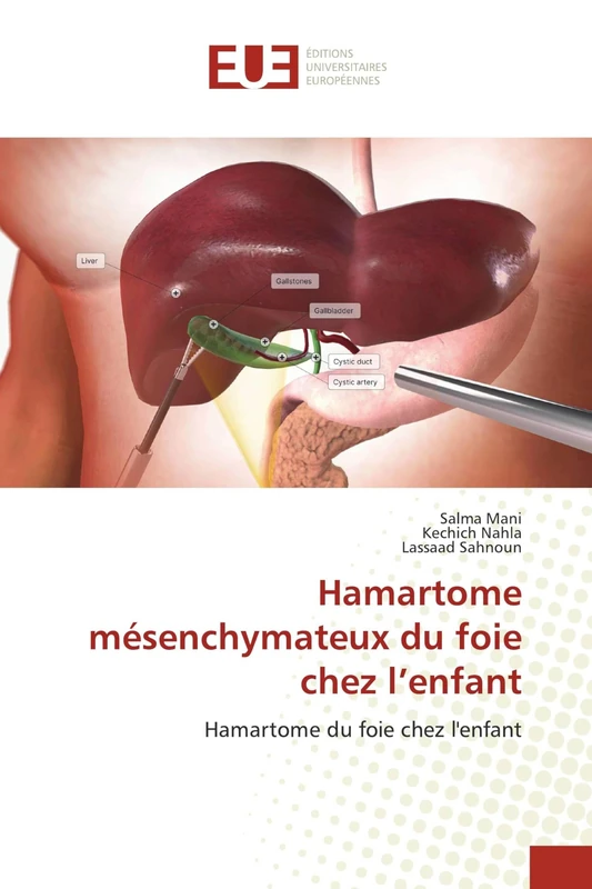 Hamartome mésenchymateux du foie chez l’enfant: Hamartome du foie chez l'enfant - Image 1