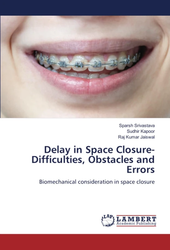 Delay in Space Closure- Difficulties, Obstacles and Errors: Biomechanical consideration in space closure