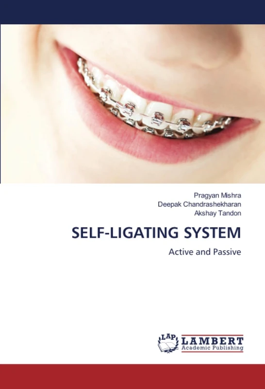 SELF-LIGATING SYSTEM: Active and Passive - Image 1