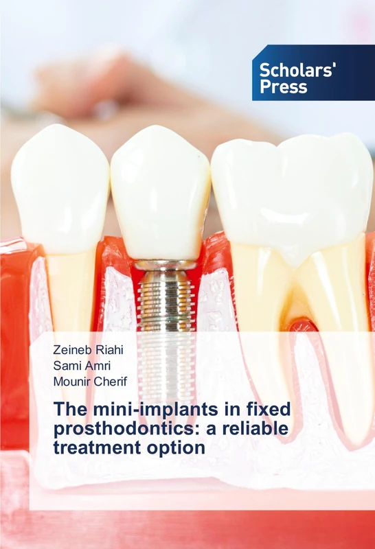 The mini-implants in fixed prosthodontics: a reliable treatment option