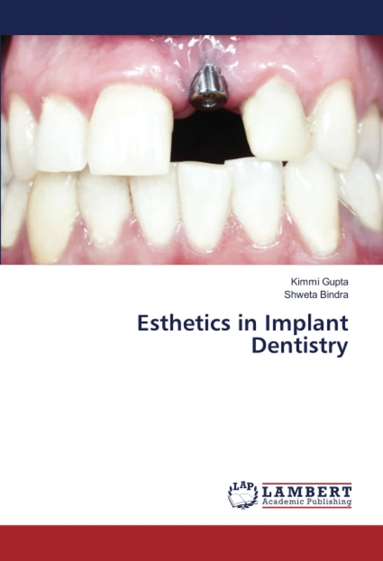 Esthetics in Implant Dentistry