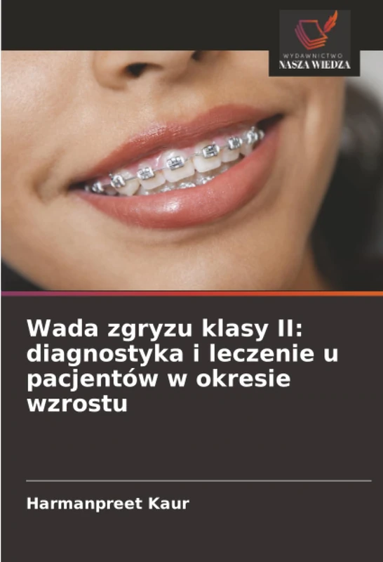 Wada zgryzu klasy II: diagnostyka i leczenie u pacjentów w okresie wzrostu