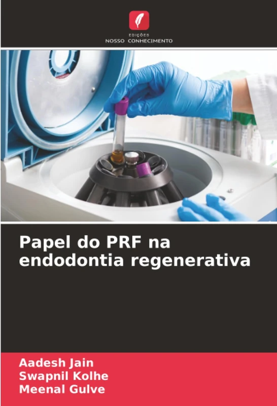 Papel do PRF na endodontia regenerativa