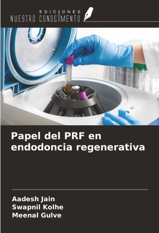 Papel del PRF en endodoncia regenerativa