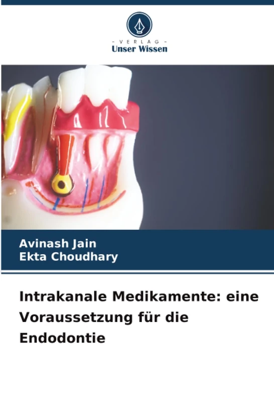 Intrakanale Medikamente: eine Voraussetzung für die Endodontie