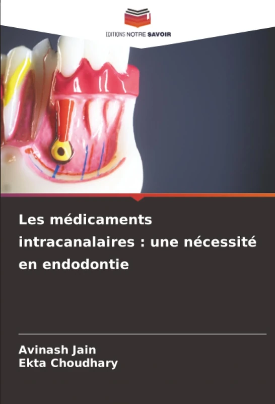 Les médicaments intracanalaires : une nécessité en endodontie