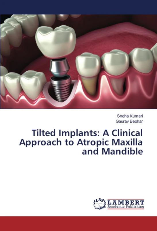 Tilted Implants: A Clinical Approach to Atropic Maxilla and Mandible