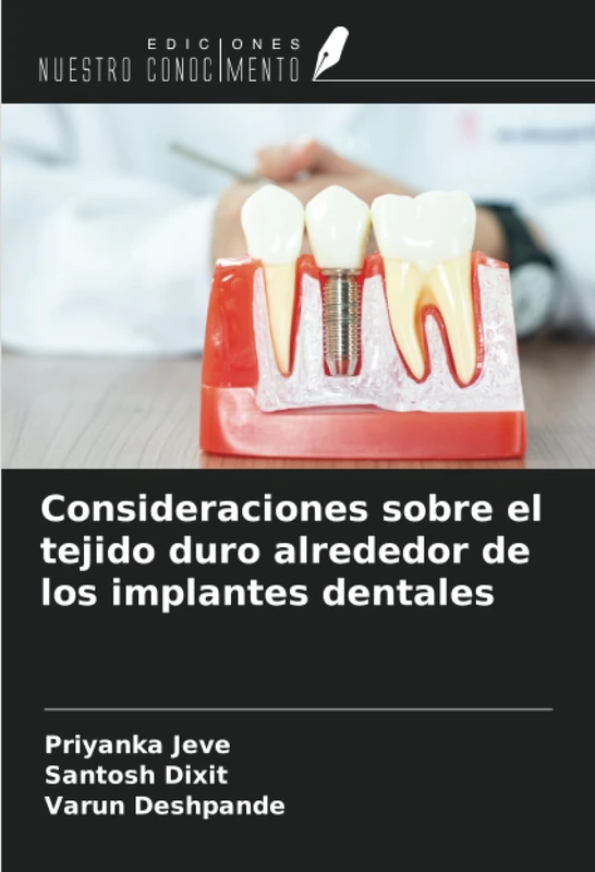 Consideraciones sobre el tejido duro alrededor de los implantes dentales