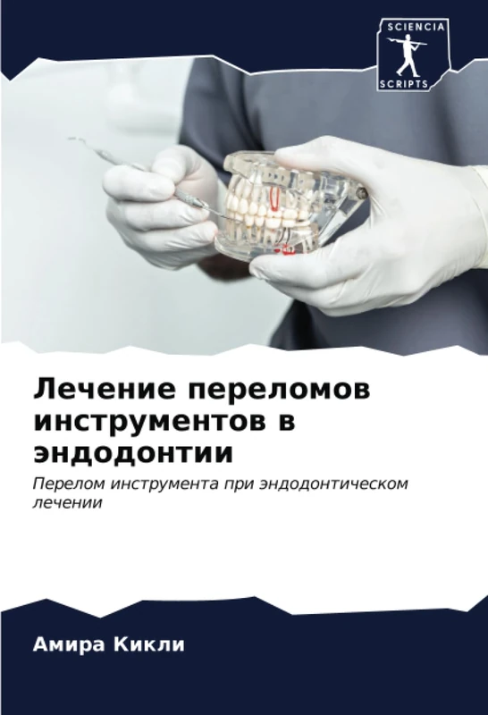 Лечение переломов инструментов в эндодонтии: Перелом инструмента при эндодонтическом лечении: Perelom instrumenta pri ändodonticheskom lechenii - Image 1