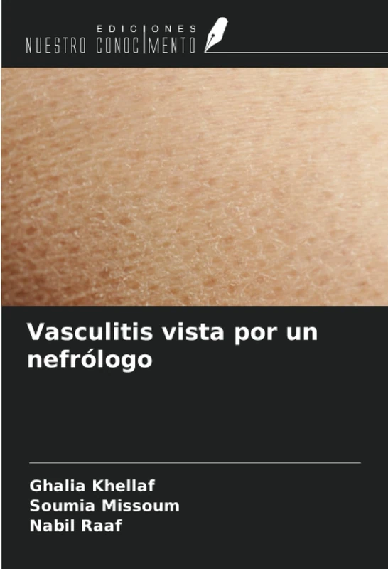 Vasculitis vista por un nefrólogo