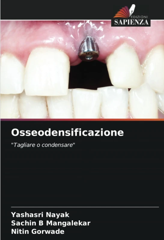 Osseodensificazione: "Tagliare o condensare" - Image 1