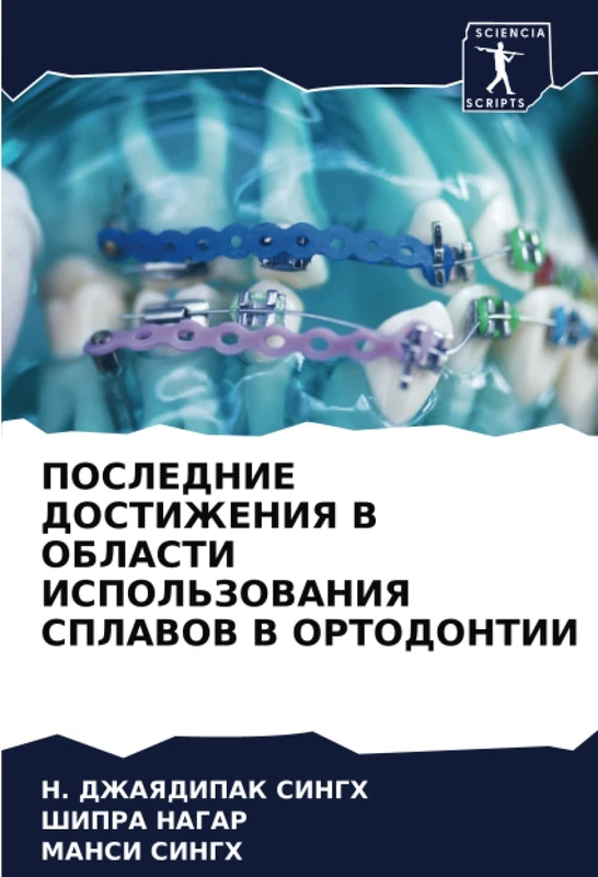 ПОСЛЕДНИЕ ДОСТИЖЕНИЯ В ОБЛАСТИ ИСПОЛЬЗОВАНИЯ СПЛАВОВ В ОРТОДОНТИИ