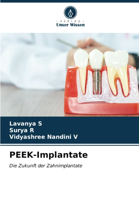 PEEK-Implantate: Die Zukunft der Zahnimplantate - Image 1