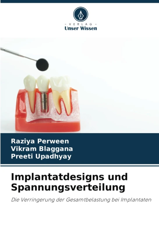 Implantatdesigns und Spannungsverteilung: Die Verringerung der Gesamtbelastung bei Implantaten