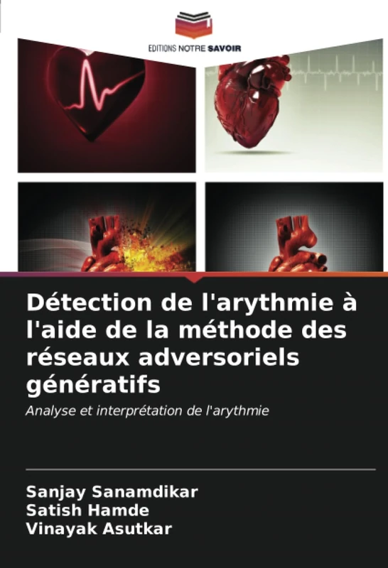 Détection de l'arythmie à l'aide de la méthode des réseaux adversoriels génératifs: Analyse et interprétation de l'arythmie
