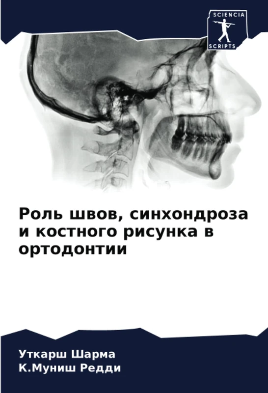Роль швов, синхондроза и костного рисунка в ортодонтии
