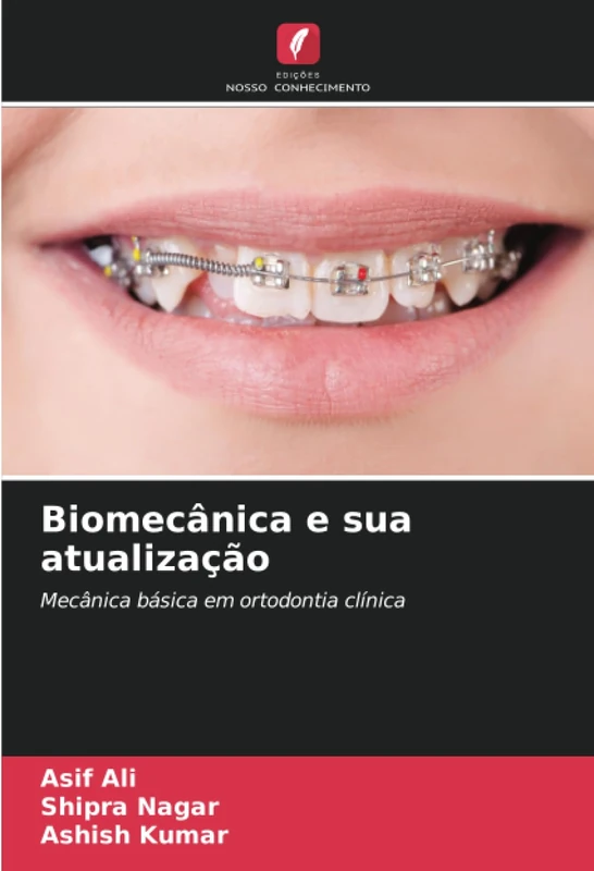 Biomecânica e sua atualização: Mecânica básica em ortodontia clínica