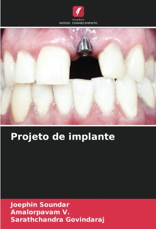 Projeto de implante