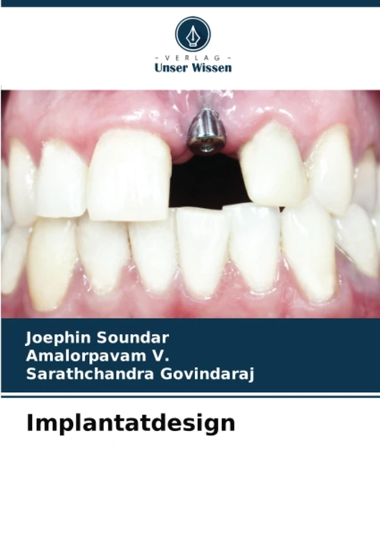 Implantatdesign