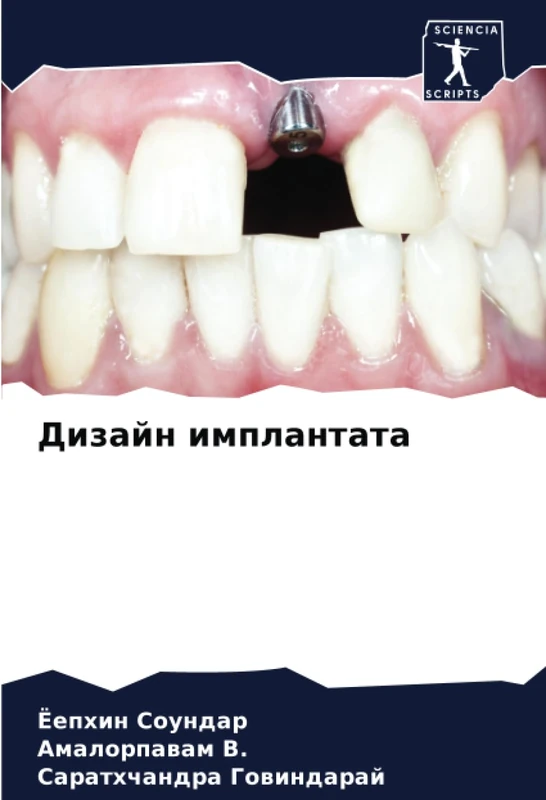 Дизайн имплантата