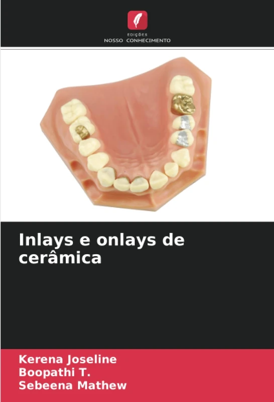 Inlays e onlays de cerâmica