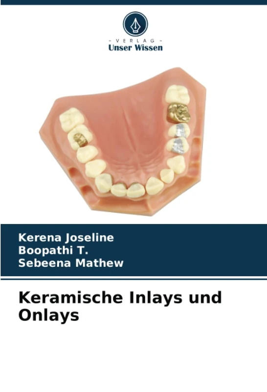 Keramische Inlays und Onlays