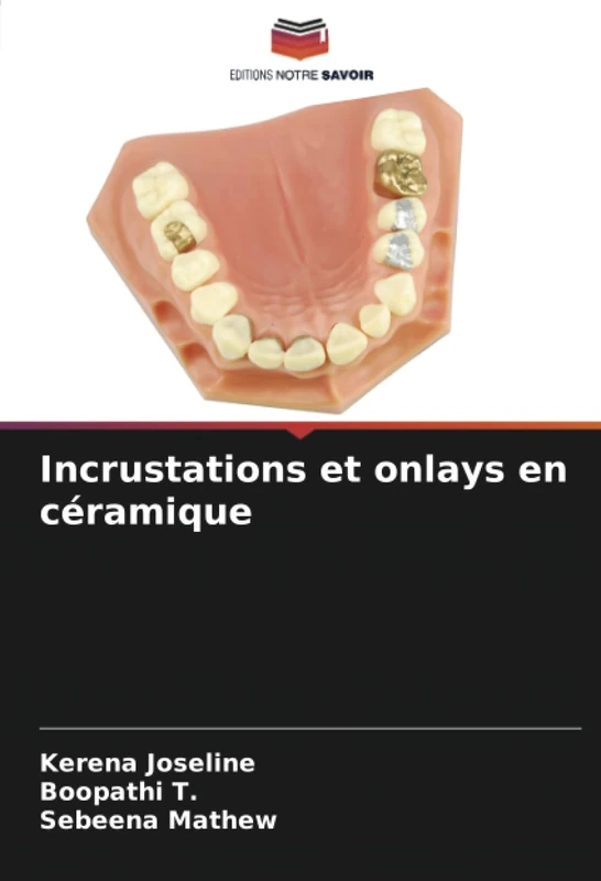Incrustations et onlays en céramique