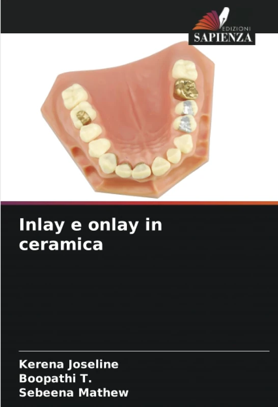Inlay e onlay in ceramica