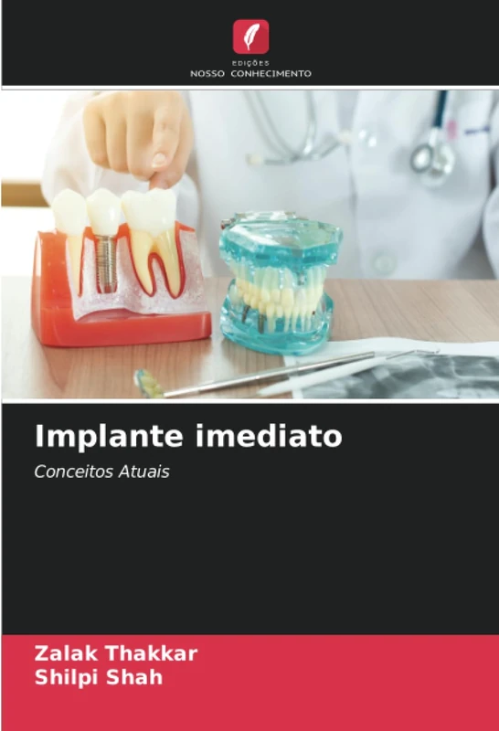 Implante imediato: Conceitos Atuais