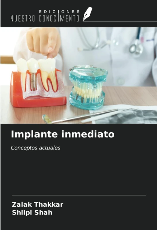 Implante inmediato: Conceptos actuales