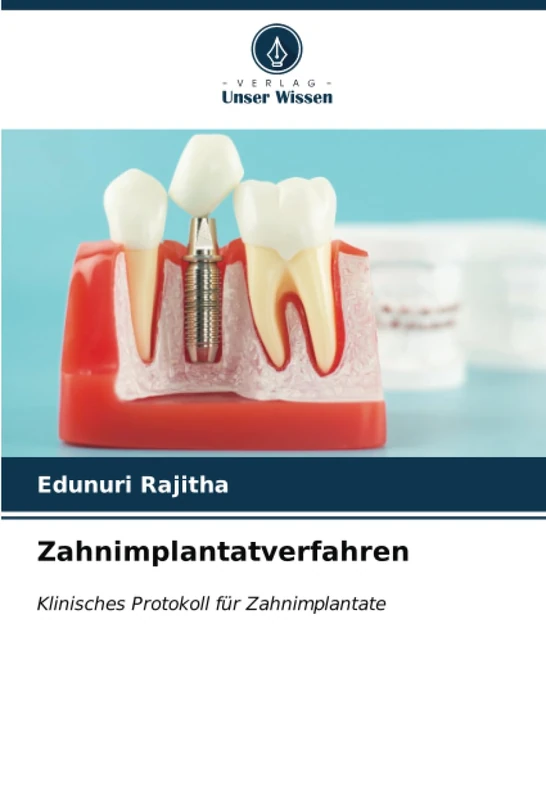 Zahnimplantatverfahren: Klinisches Protokoll für Zahnimplantate