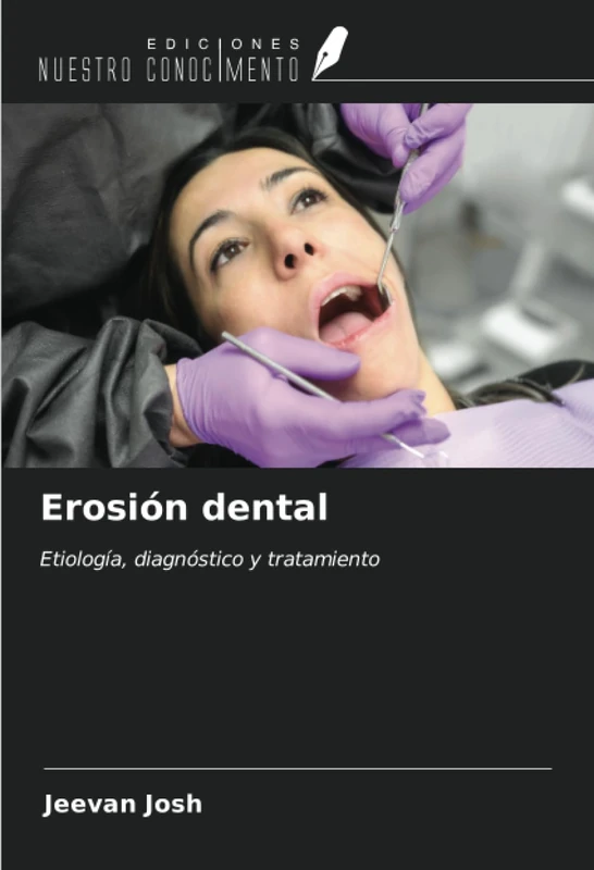 Erosión dental: Etiología, diagnóstico y tratamiento