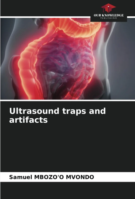 Ultrasound traps and artifacts - Image 1