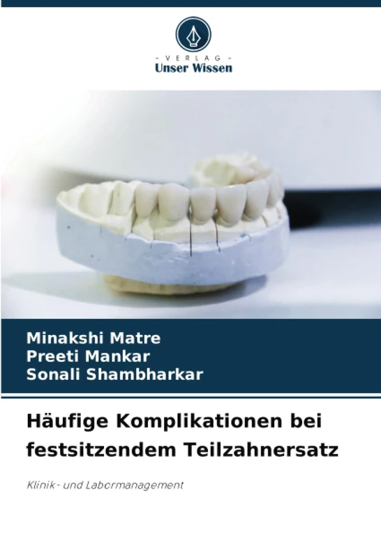 Häufige Komplikationen bei festsitzendem Teilzahnersatz: Klinik- und Labormanagement - Image 1