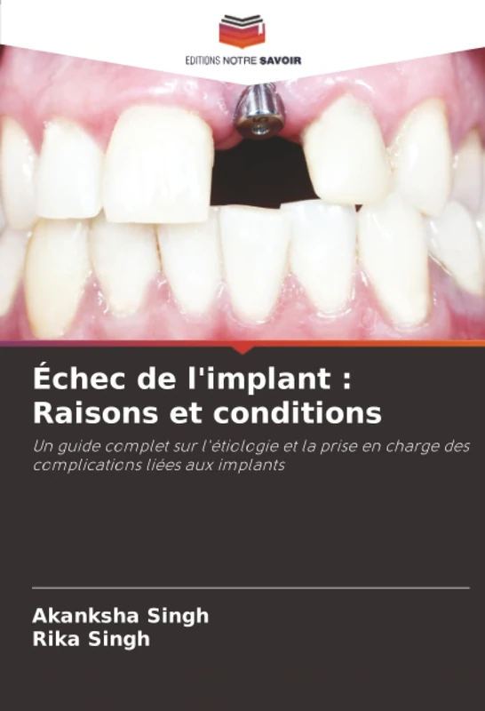 Échec de l'implant : Raisons et conditions: Un guide complet sur l'étiologie et la prise en charge des complications liées aux implants