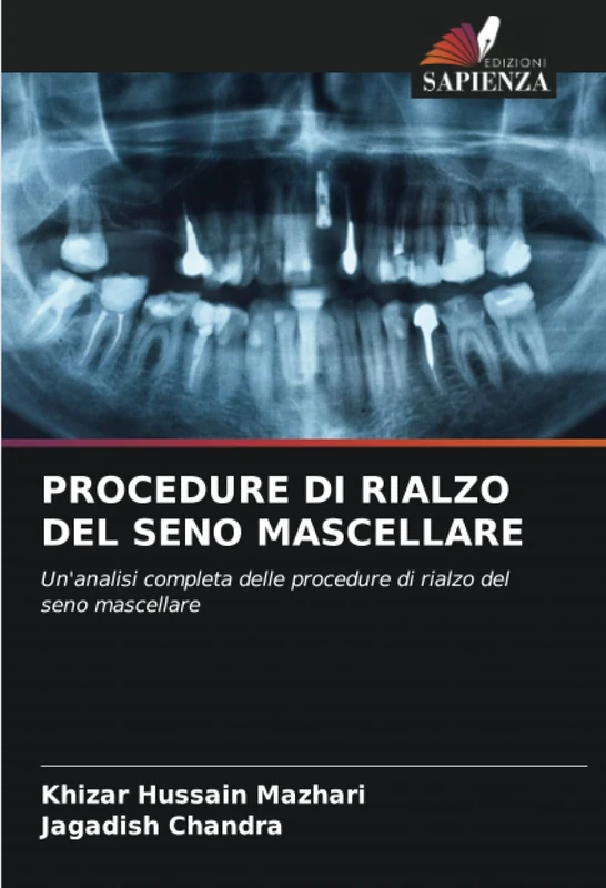 PROCEDURE DI RIALZO DEL SENO MASCELLARE: Un'analisi completa delle procedure di rialzo del seno mascellare