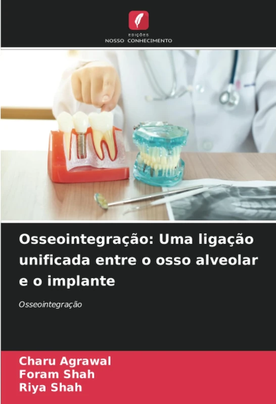 Osseointegração: Uma ligação unificada entre o osso alveolar e o implante: Osseointegração