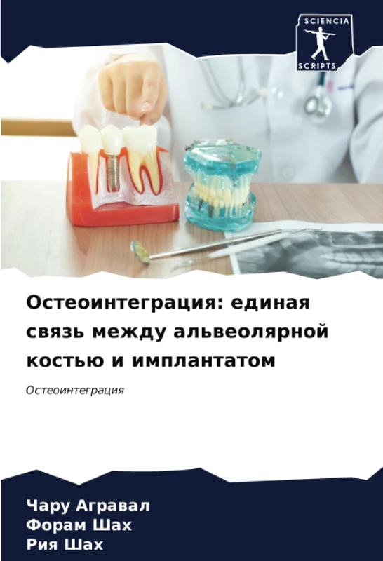 Остеоинтеграция: единая связь между альвеолярной костью и имплантатом: Остеоинтеграция