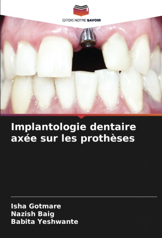 Implantologie dentaire axée sur les prothèses