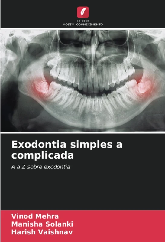 Exodontia simples a complicada: A a Z sobre exodontia