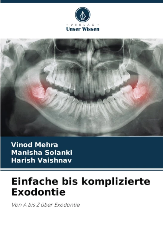 Einfache bis komplizierte Exodontie: Von A bis Z über Exodontie